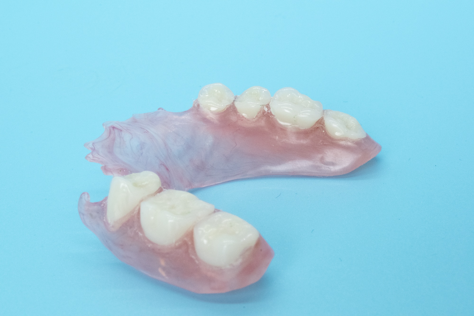 TCS Flexible Partial Denture