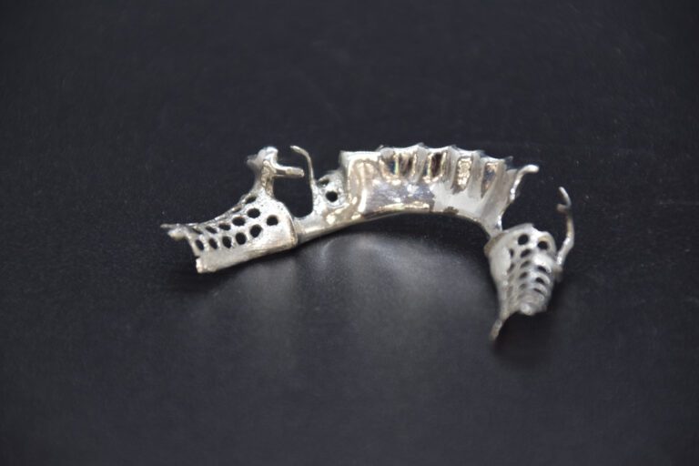 DMLS Metal Partial Frame