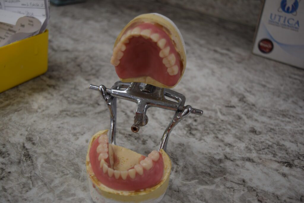 Wax Try-In