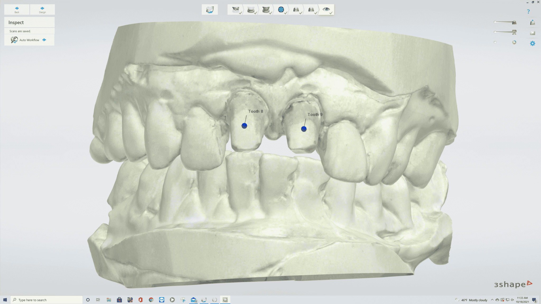 Crown and Bridge - Utica Dental Lab