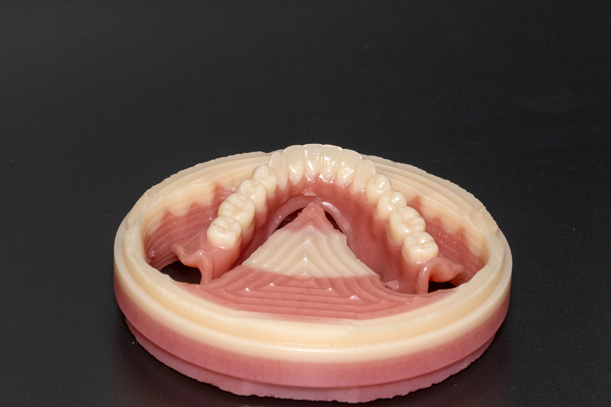 Ivotion Milled Denture