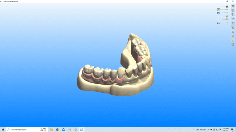 Partial Denture Design