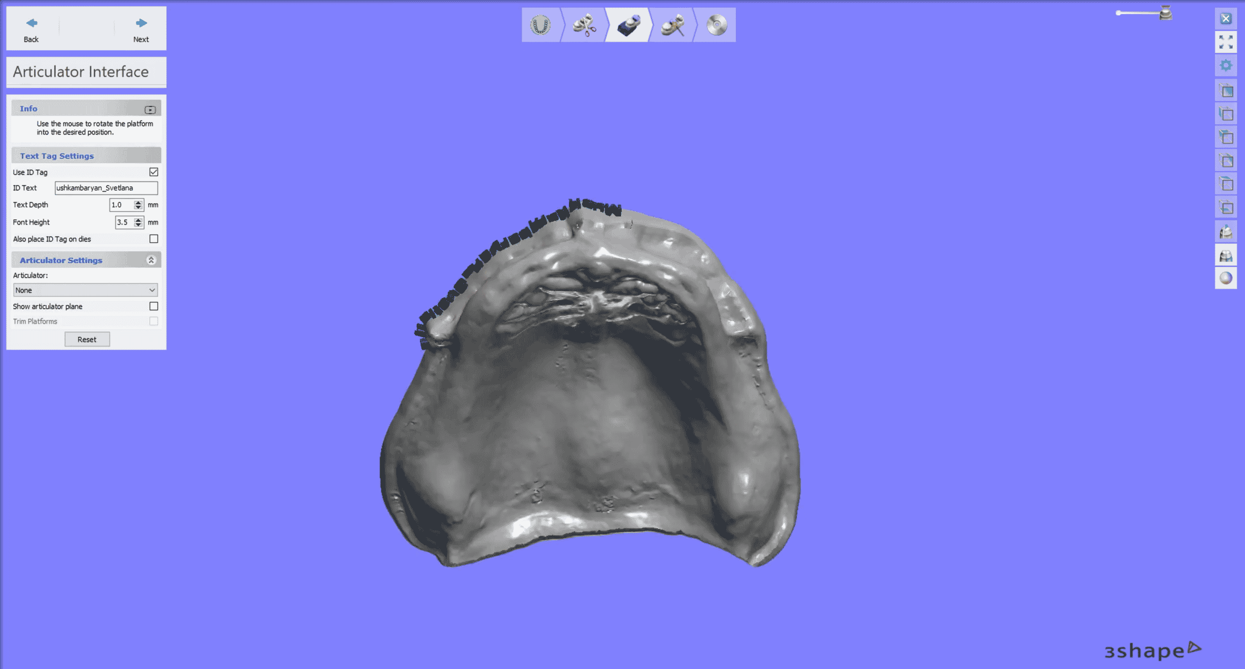 Edentulous Scan for 3d printed model